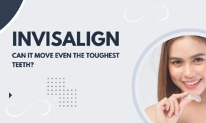 Invisalign